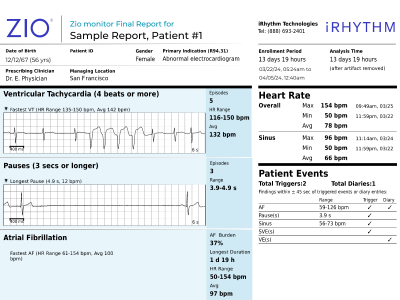 ZIO MONITOR PATIENT REPORT SAMPLE #1.PDF